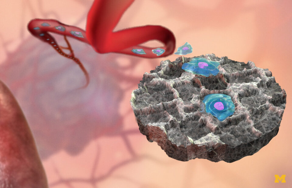 cancer-decoy-could-attract-capture-malignant-cells-orig-20150910