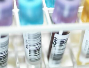 HIV tedavisinde yeni gelişme