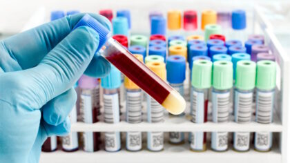 Ağrı şiddetini belirleyebilen kan testi
