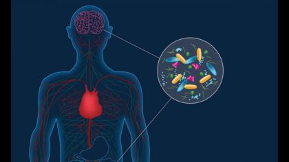 Parkinson beyinde değil; bağırsaklarda başlıyor